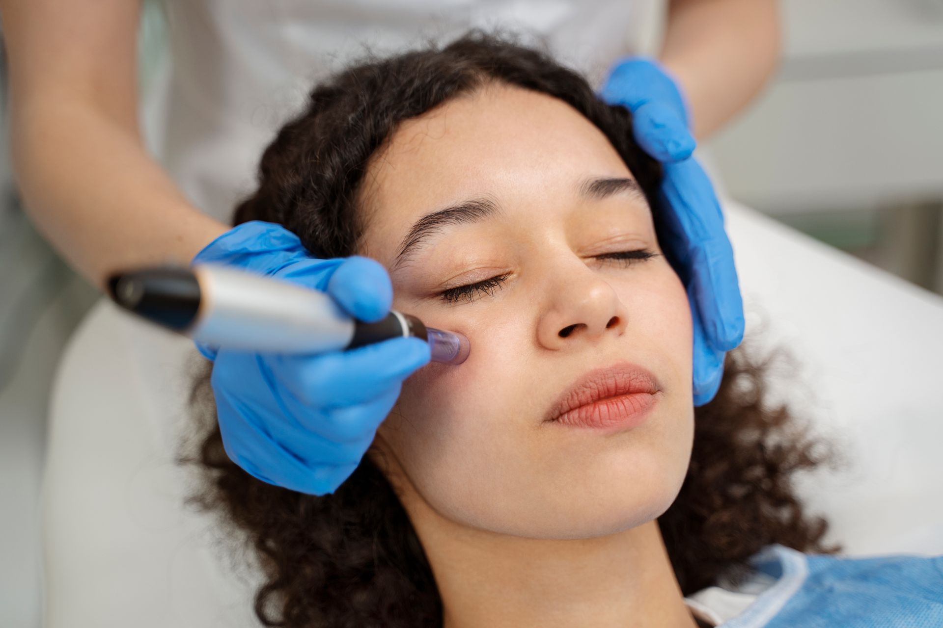 Person receiving facial microneedling treatment at a clinic, with tool and gloved hands on face.
