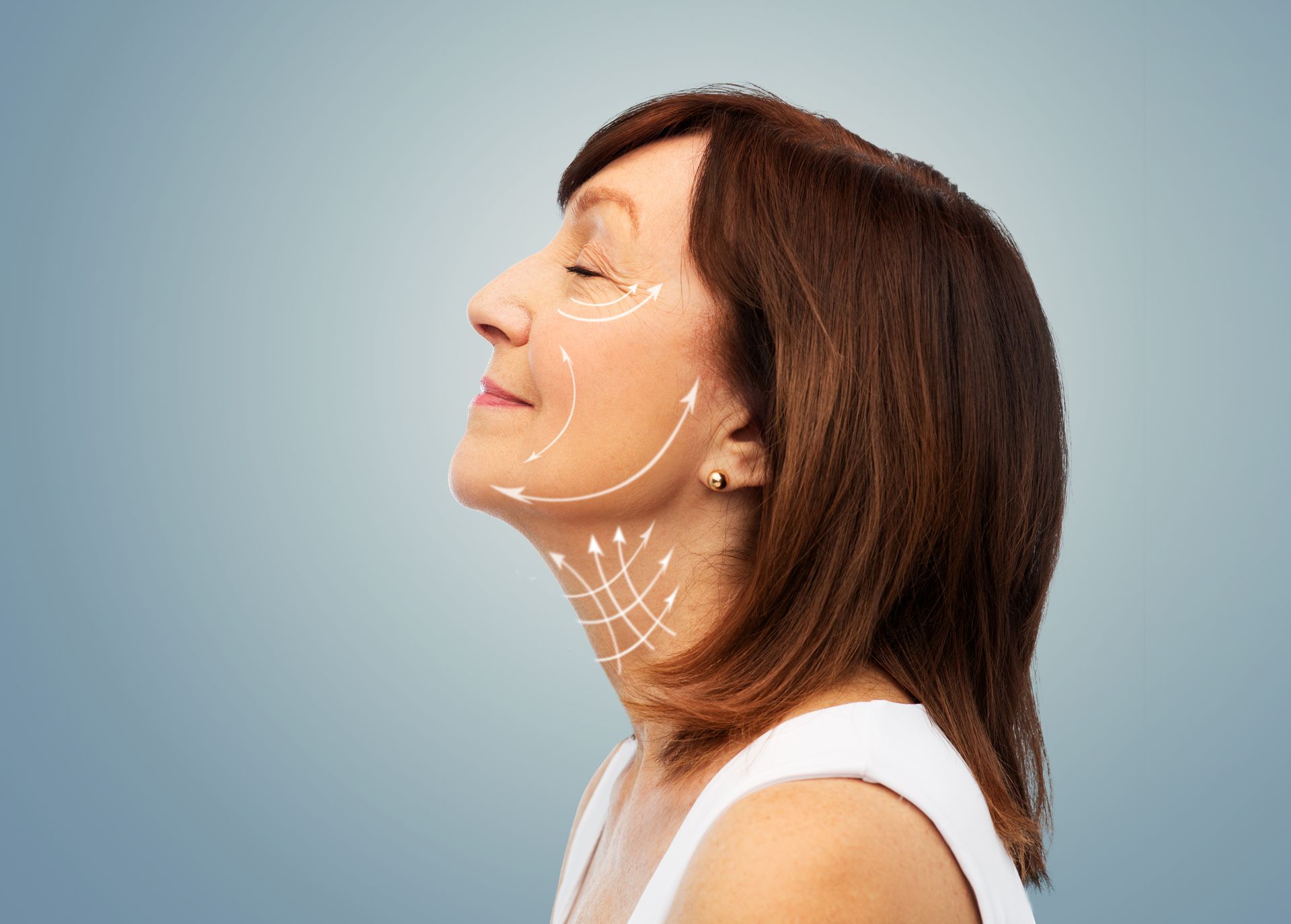 Woman's face in profile with arrows indicating cosmetic surgery on skin, against a blue background.