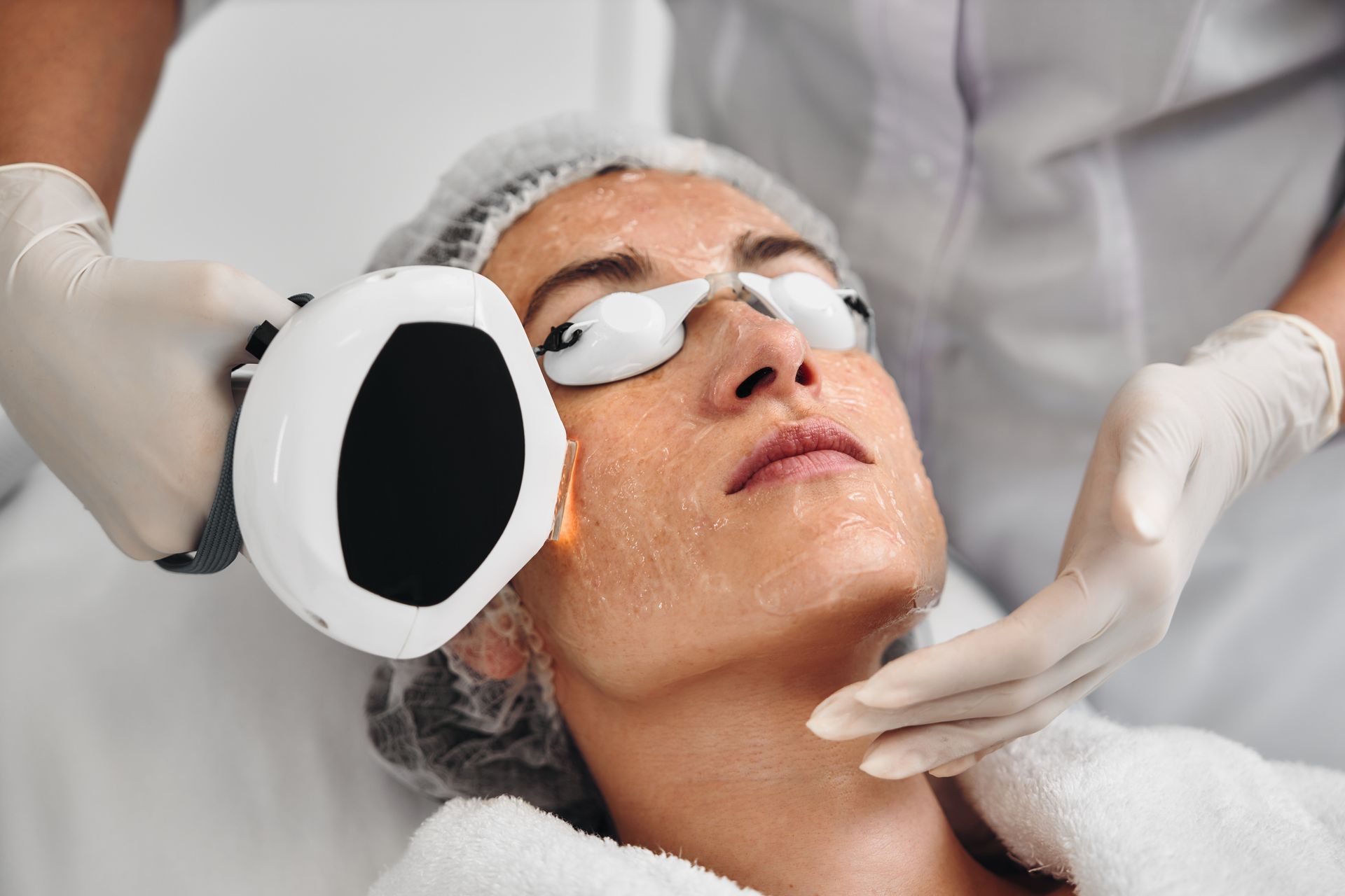 Woman receiving laser facial treatment; medical professional holding device, wearing gloves and safety glasses.