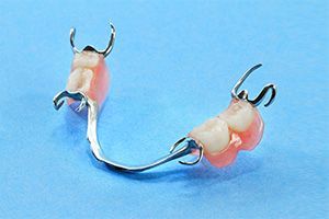 A partial denture is sitting on a blue surface.