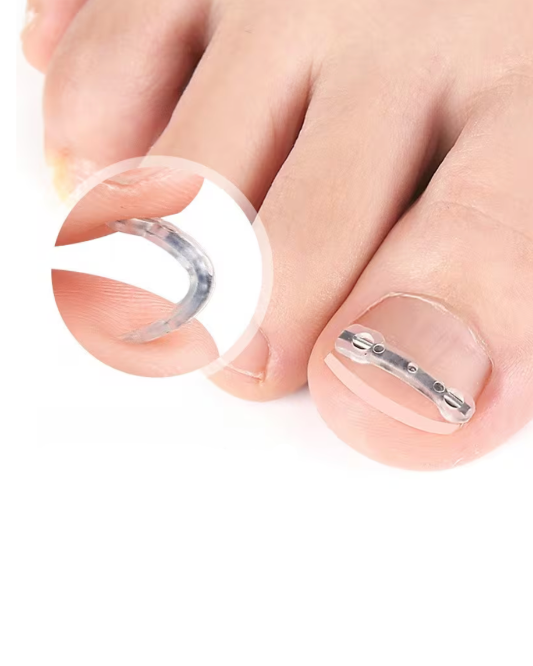 고급 페디큐어   추가 손톱 교정