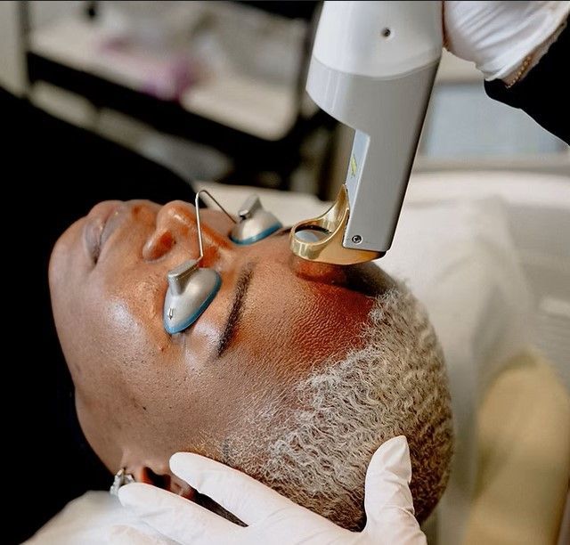 Chemical Peels