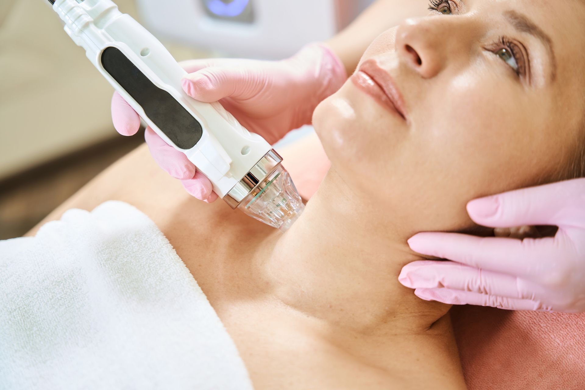 RF Microneedling