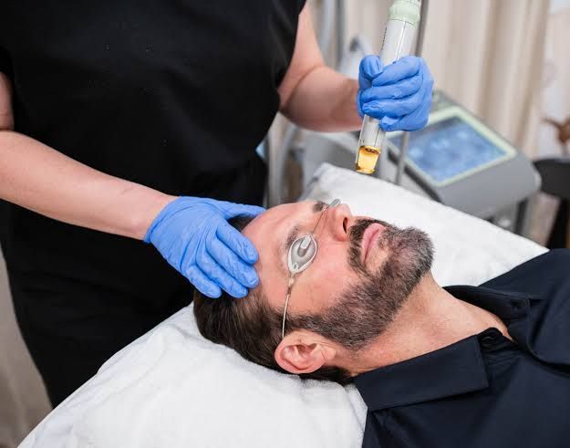 Chemical Peels