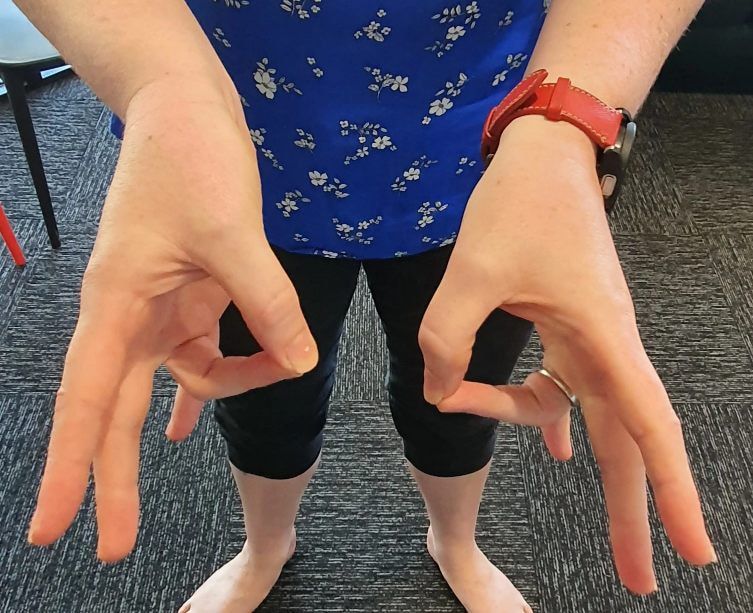 A Person is Demonstrating a Finger Exercise — Anderson Family Chiropractic Health Centre in Mount Pleasant, QLD
