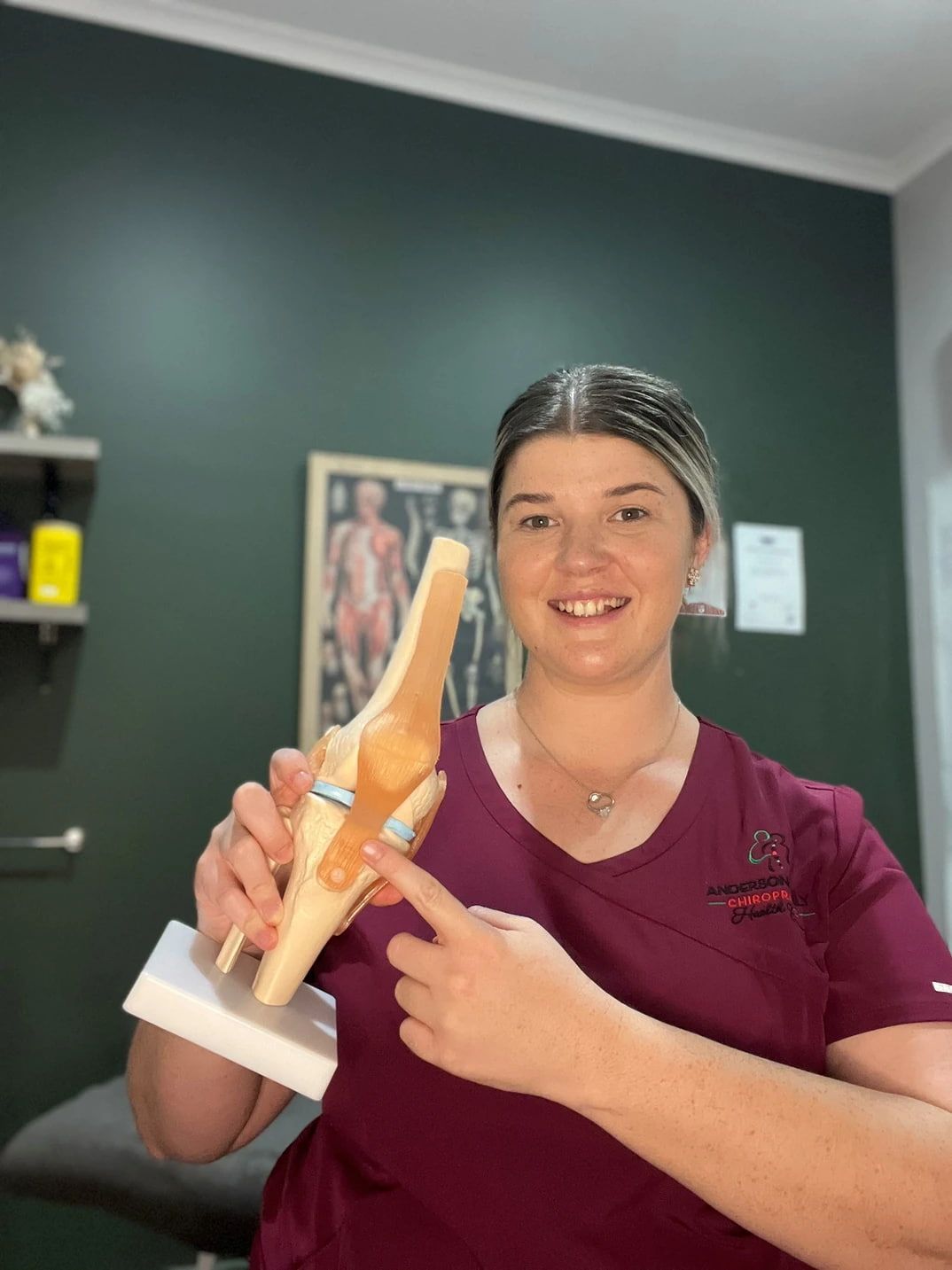 A Woman is Holding a Model of a Knee Joint — Anderson Family Chiropractic Health Centre in Mount Pleasant, QLD