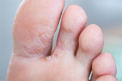 PRIME FEET EXPERTO EN PODOLOGIA