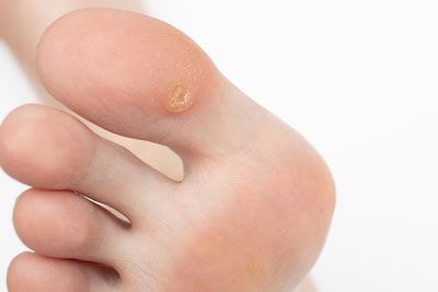 PRIME FEET EXPERTO EN PODOLOGIA