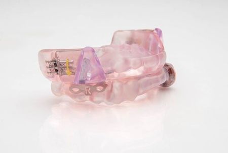 Fusion alone — Dentures in Virginia Beach, VA