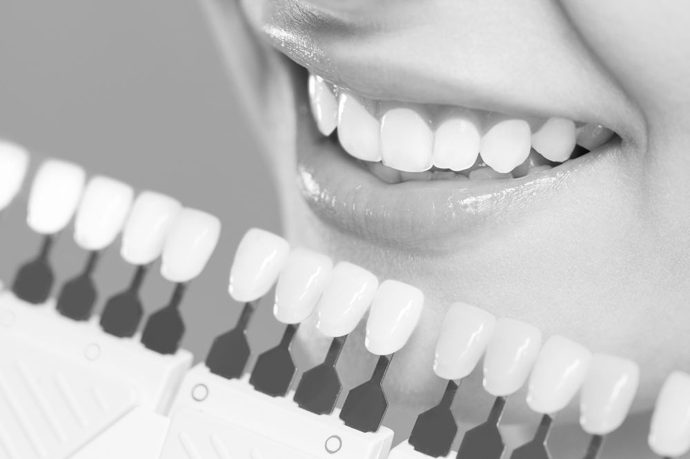 White Teeth of a Young Woman — Mildura, VIC — Tankard Dental Surgery