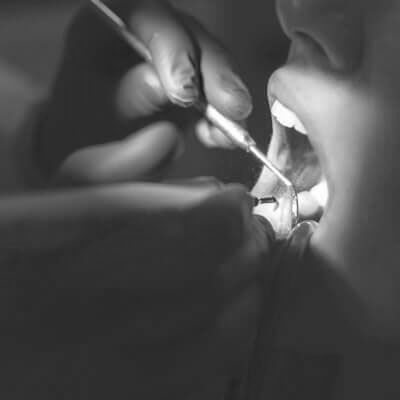 General Anaesthetic — Mildura, VIC — Tankard Dental Surgery