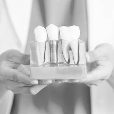 Dentist Holding Tooth Model — Mildura, VIC — Tankard Dental Surgery