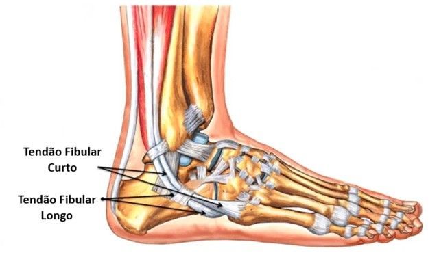 Tendinopatia dos tendões fibulares