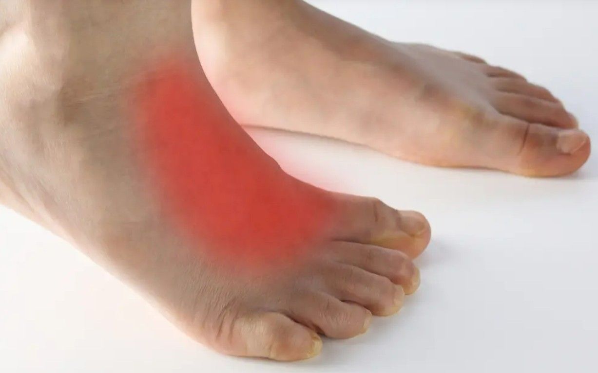 Artrose Tarso Metatarsal do pé