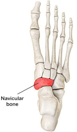 navicular acessório