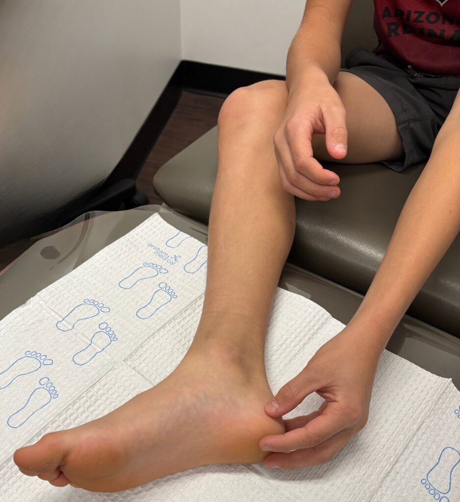 osteocondrite de sever