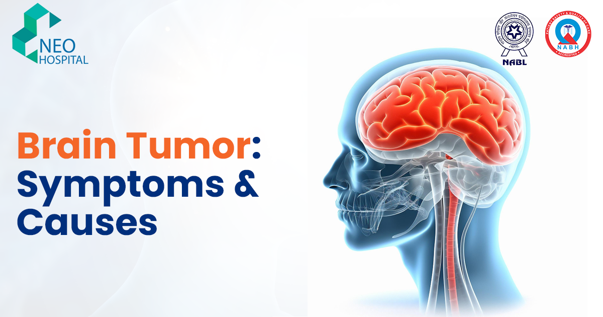 Brain Tumor: Symptoms & Causes