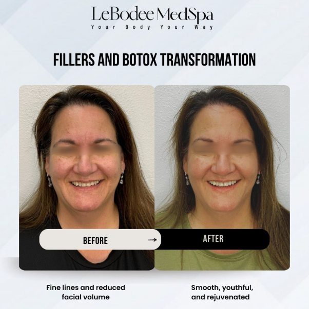 A before and after picture of a woman 's face