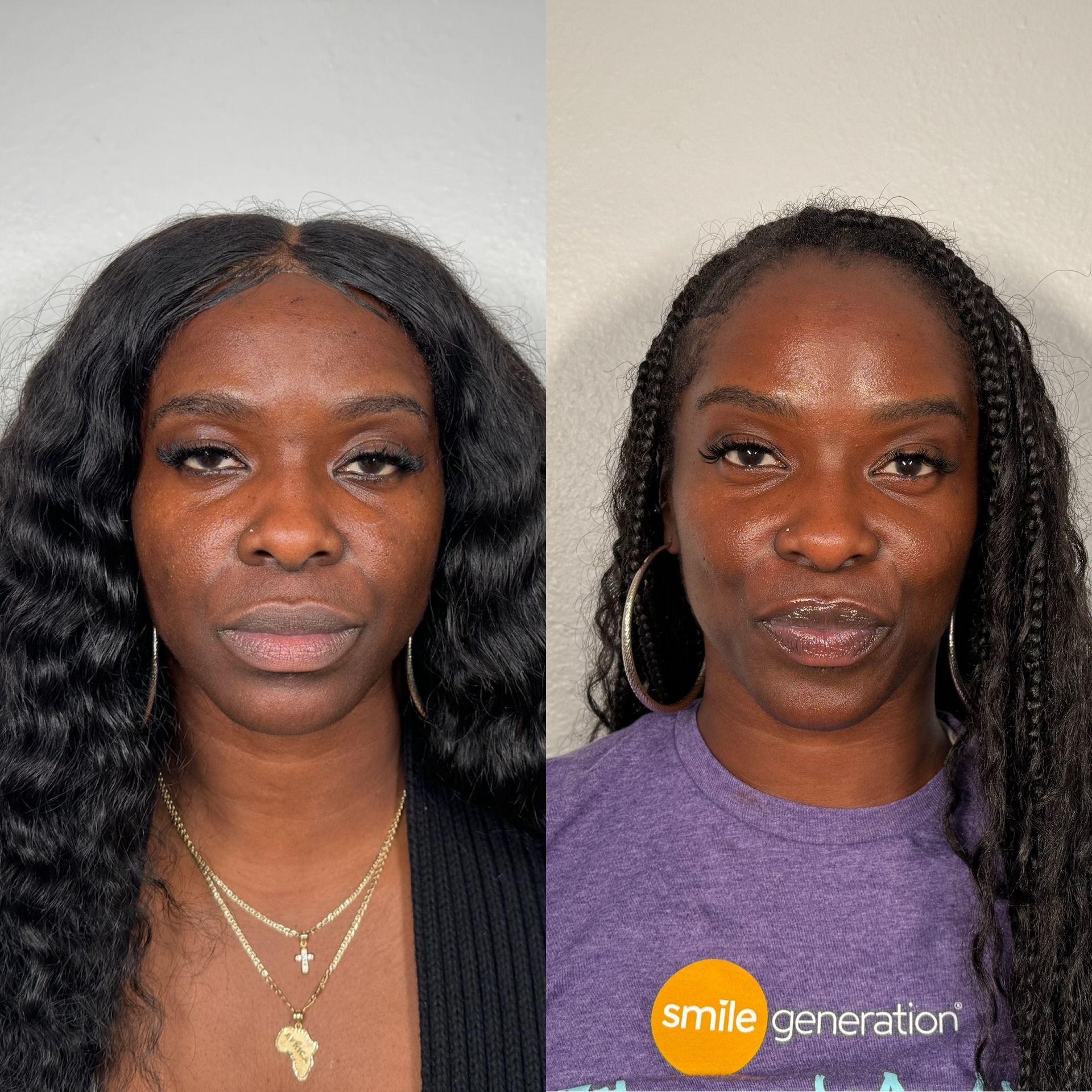 A before and after photo of a woman 's face.