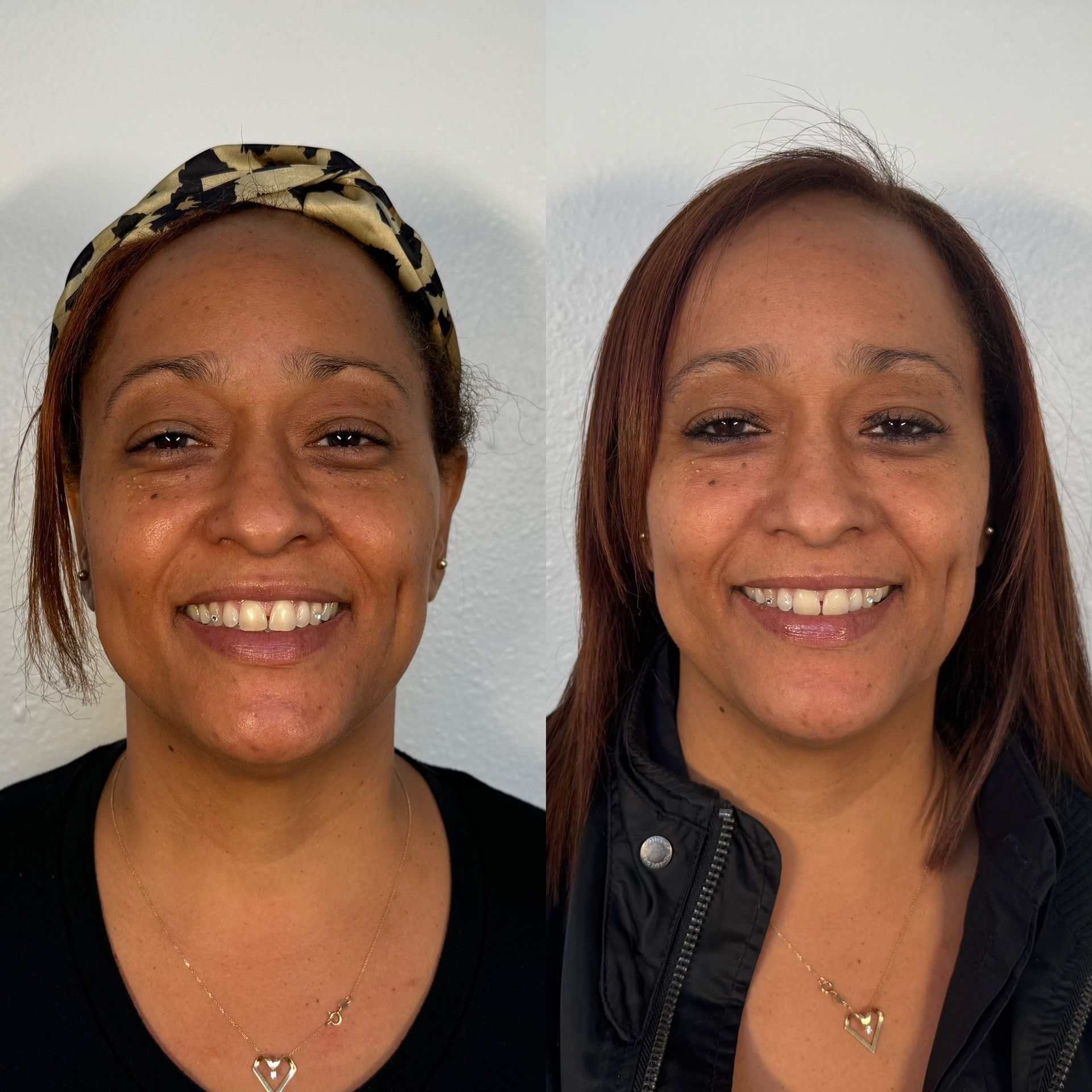A before and after photo of a woman smiling