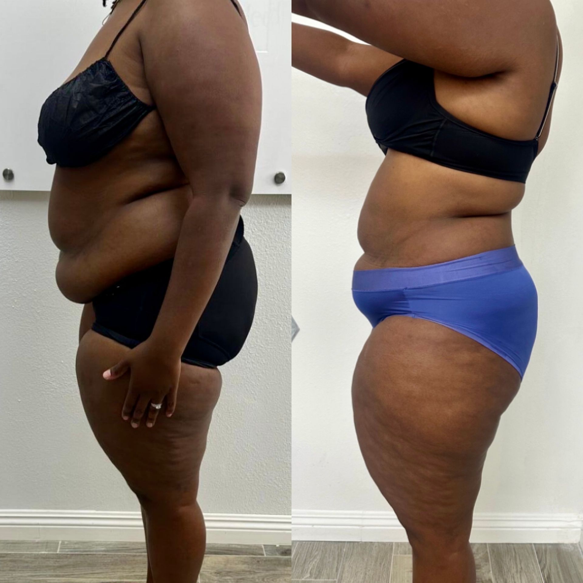 A before and after photo of a woman 's body