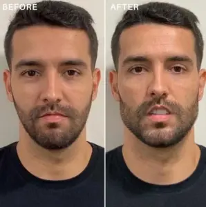 A before and after picture of a man with a beard.