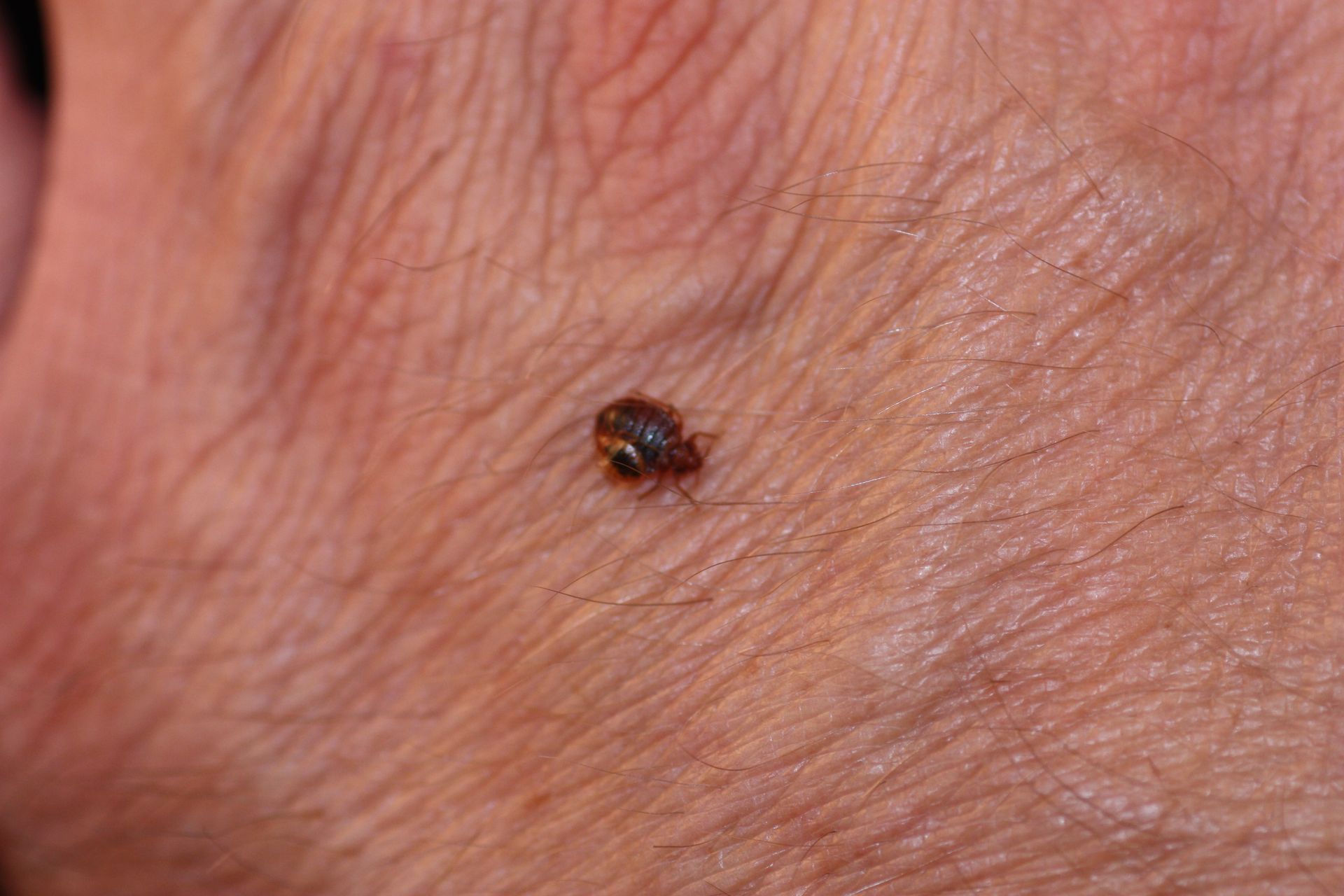 tiny bed bug crawling on skin