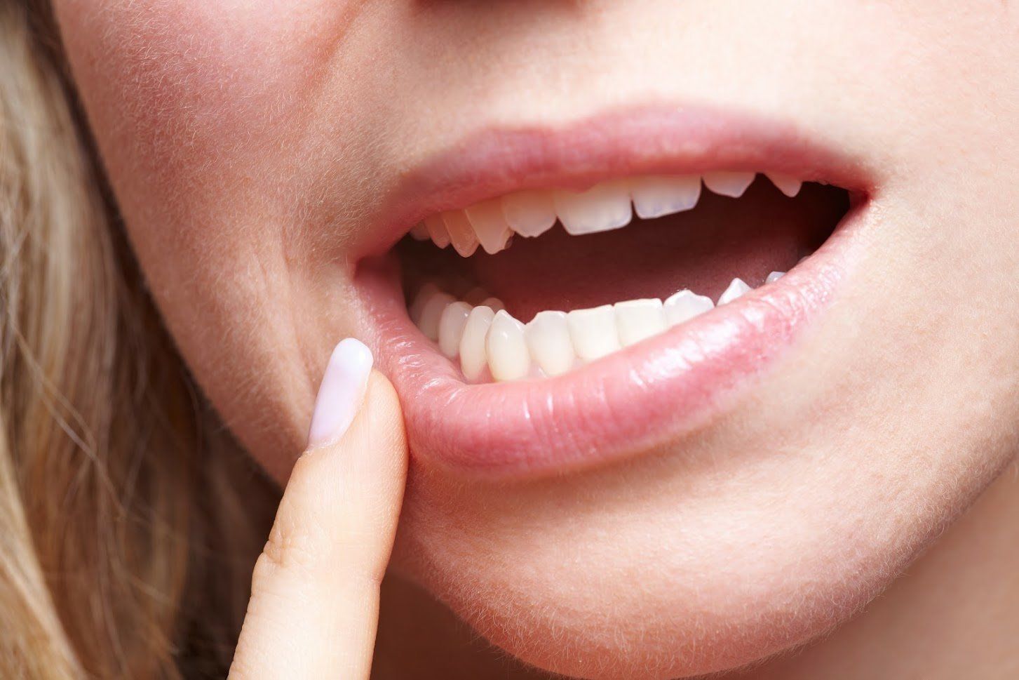 Woman Having a Tooth Ache — San Diego, CA — San Diego Center for Oral & Maxillofacial Surgery