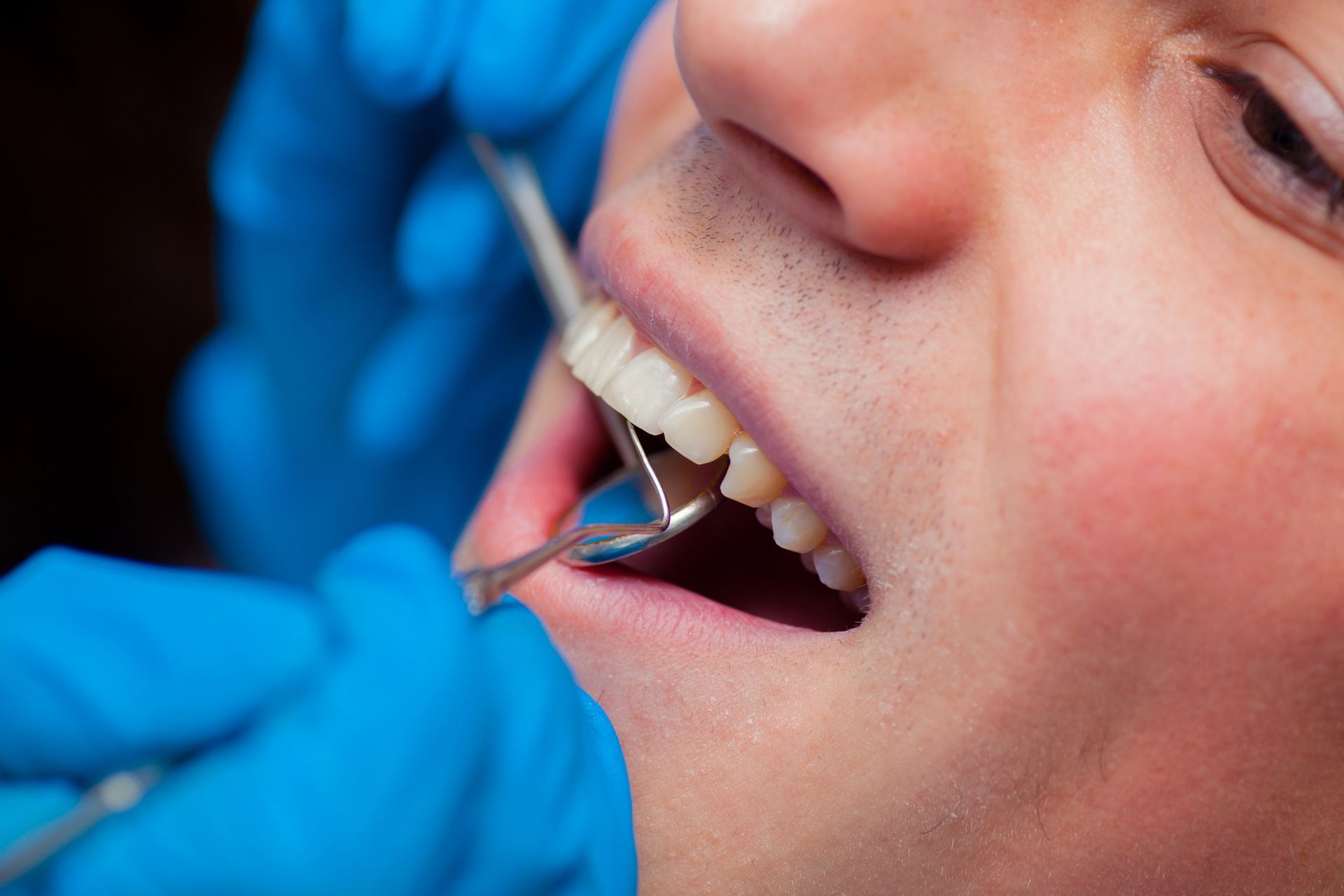 Dentist treatment a patient's teeth in the dentist.
