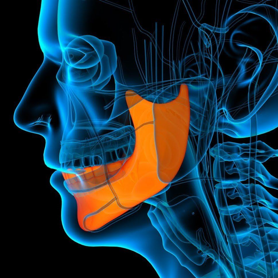 Jawbone Atrophy — San Diego, CA — San Diego Center for Oral & Maxillofacial Surgery