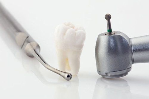 Wisdom Tooth Extraction — San Diego, CA — San Diego Center for Oral & Maxillofacial Surgery