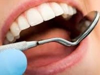 dentista che verifica la presenza di carie nella bocca di una paziente