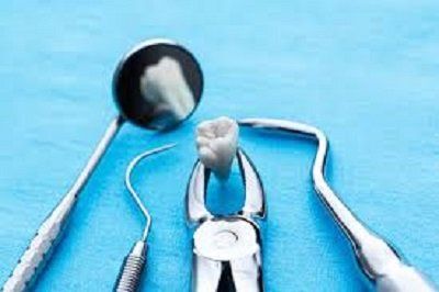 strumenti per la rimozione dei denti