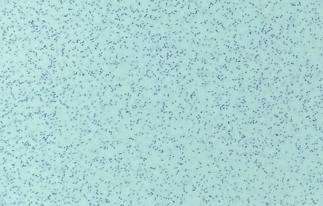 Light blue background with numerous small, dark blue, elongated specks.