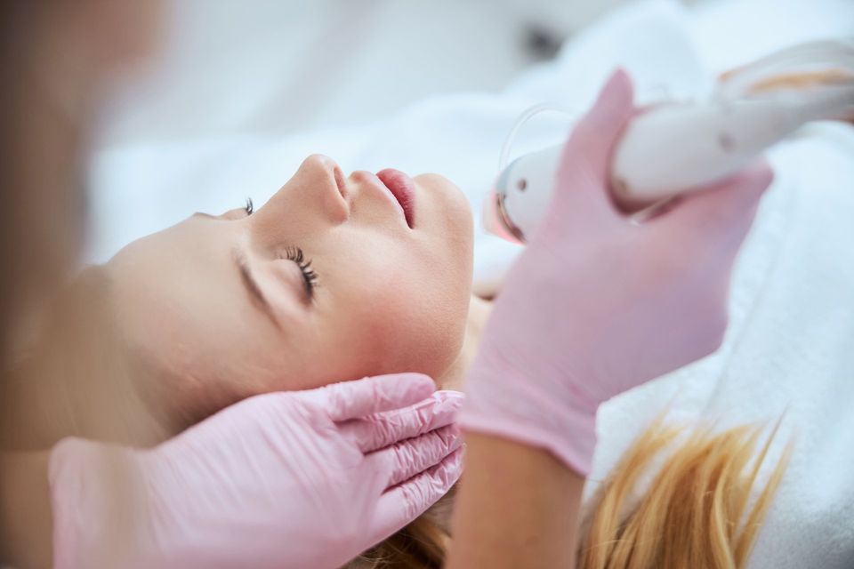 vivace-rf-microneedling