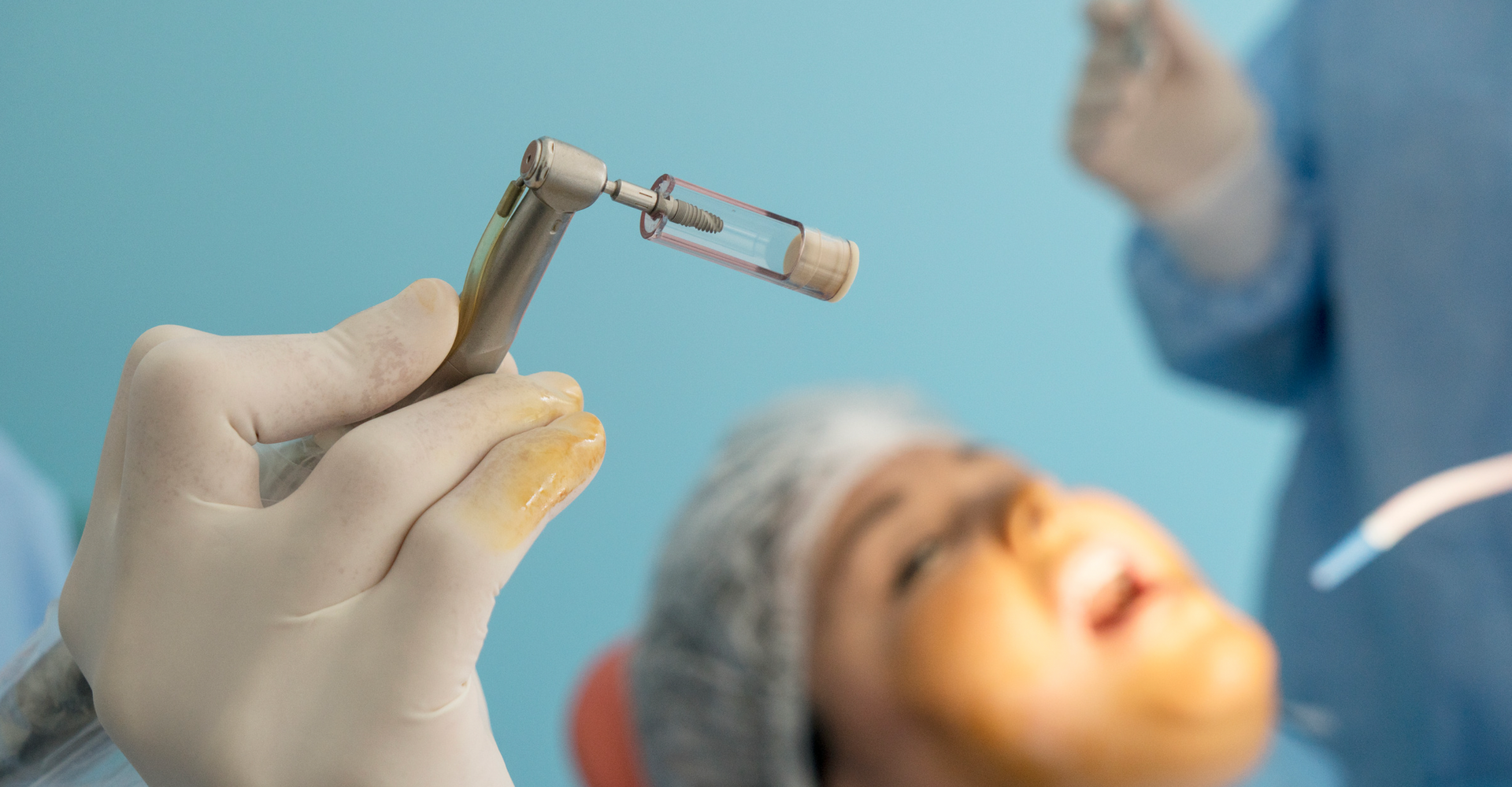 7 Tips to Avoid Infection After Implant Surgery