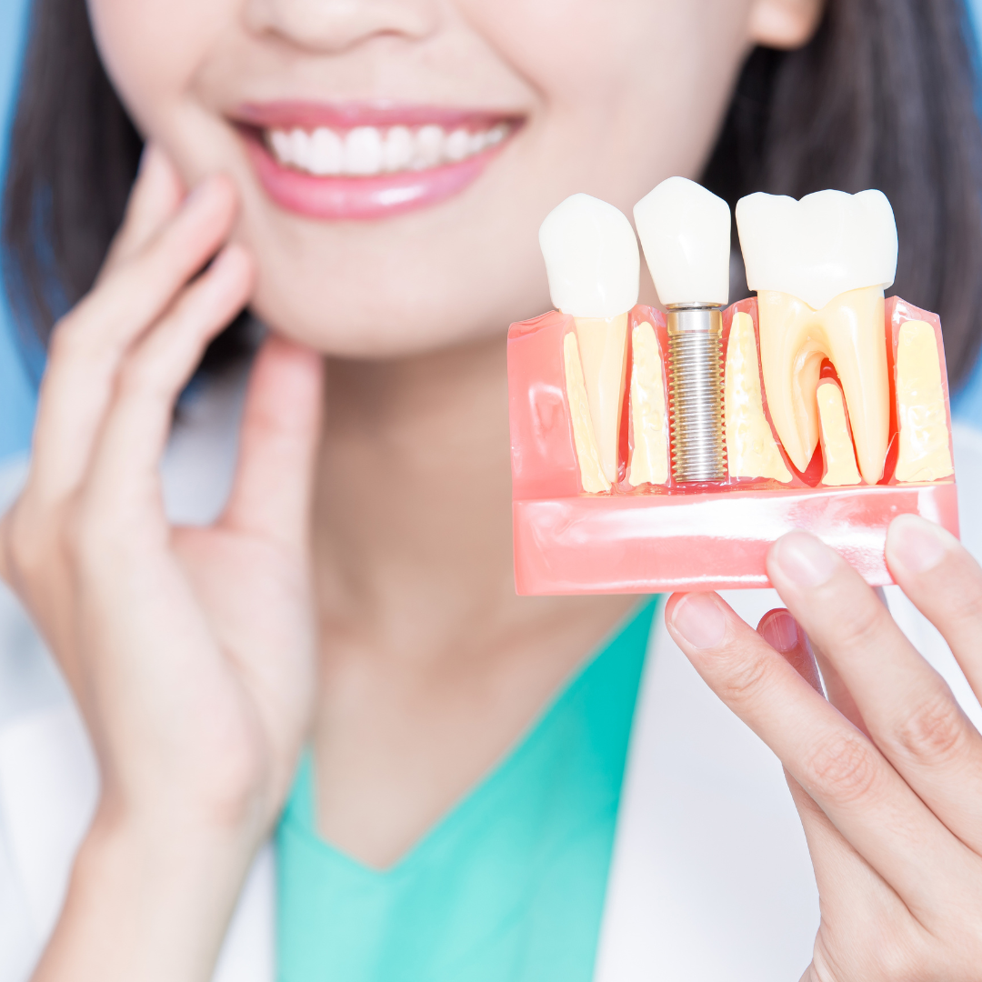10 Questions to Ask Your Dentist Before Getting Dental Implants