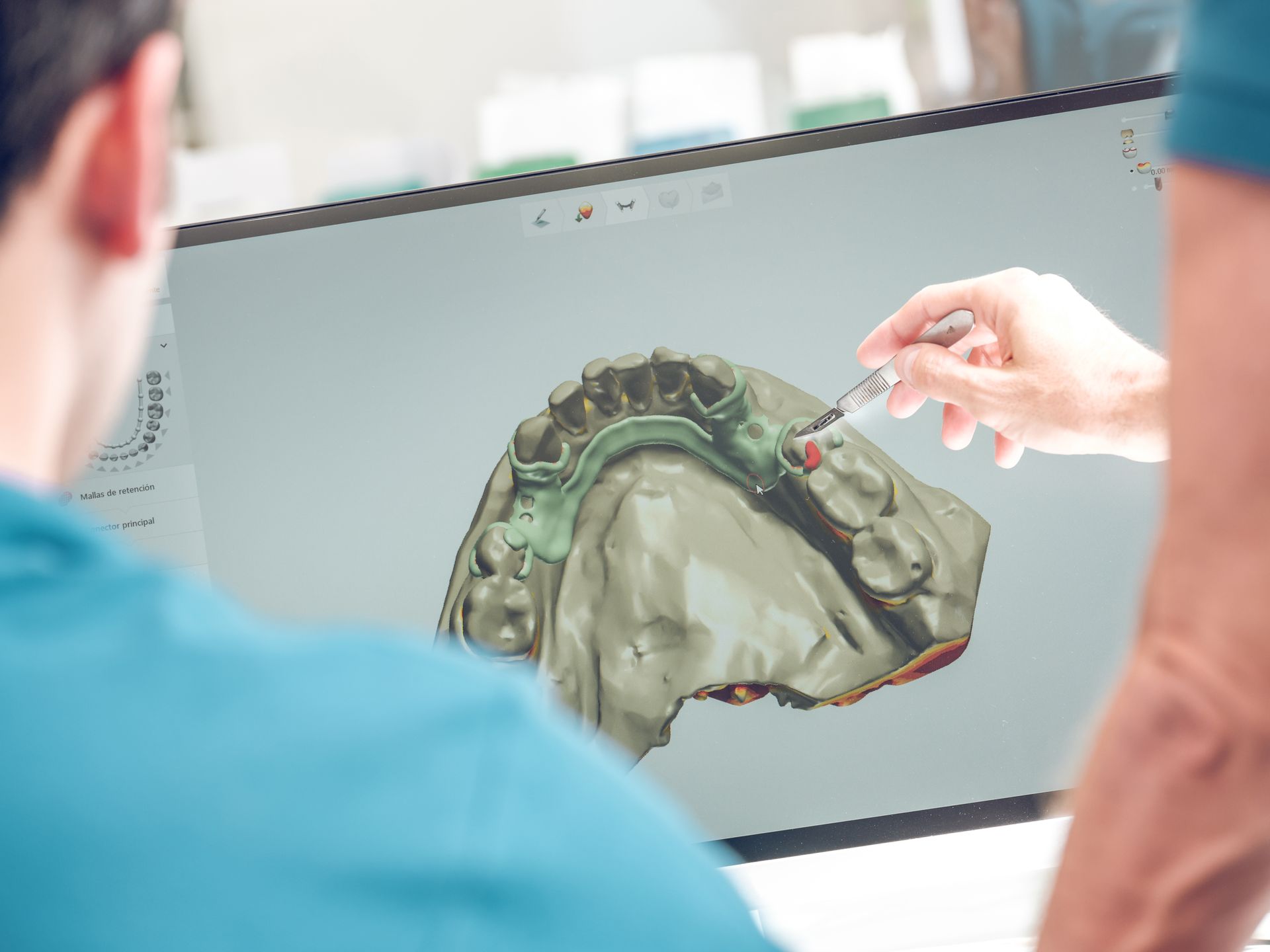 A man is looking at a computer screen with a model of jaw on it.