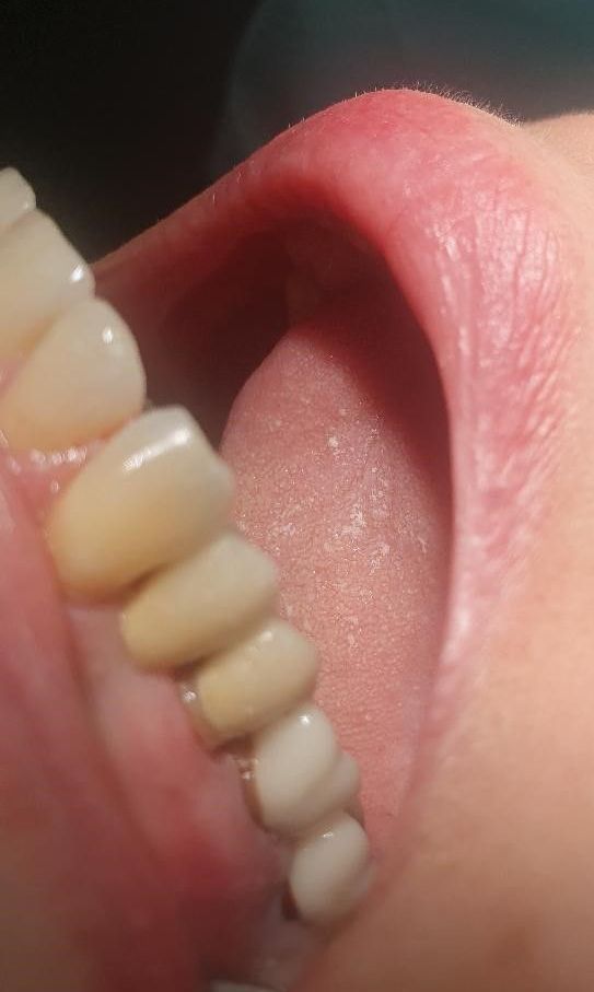 A dentist is checking a patient's teeth with a mirror.