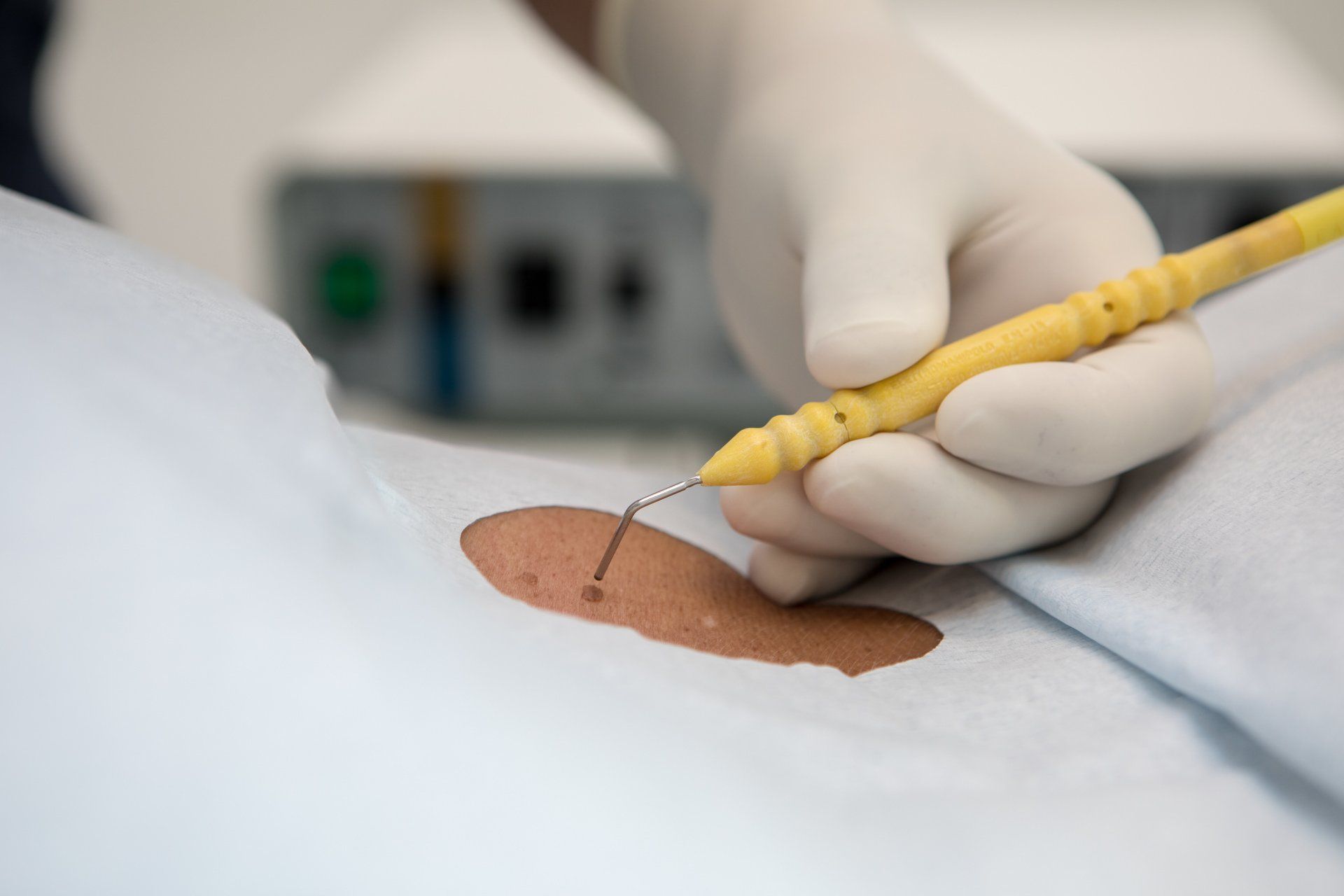 trattamento di chirurgia estetica Venezia con filler