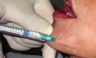 terapia invecchiamento delle pelle