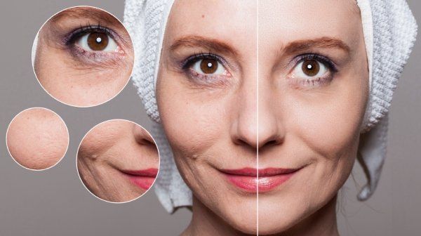 Ringiovanimento viso