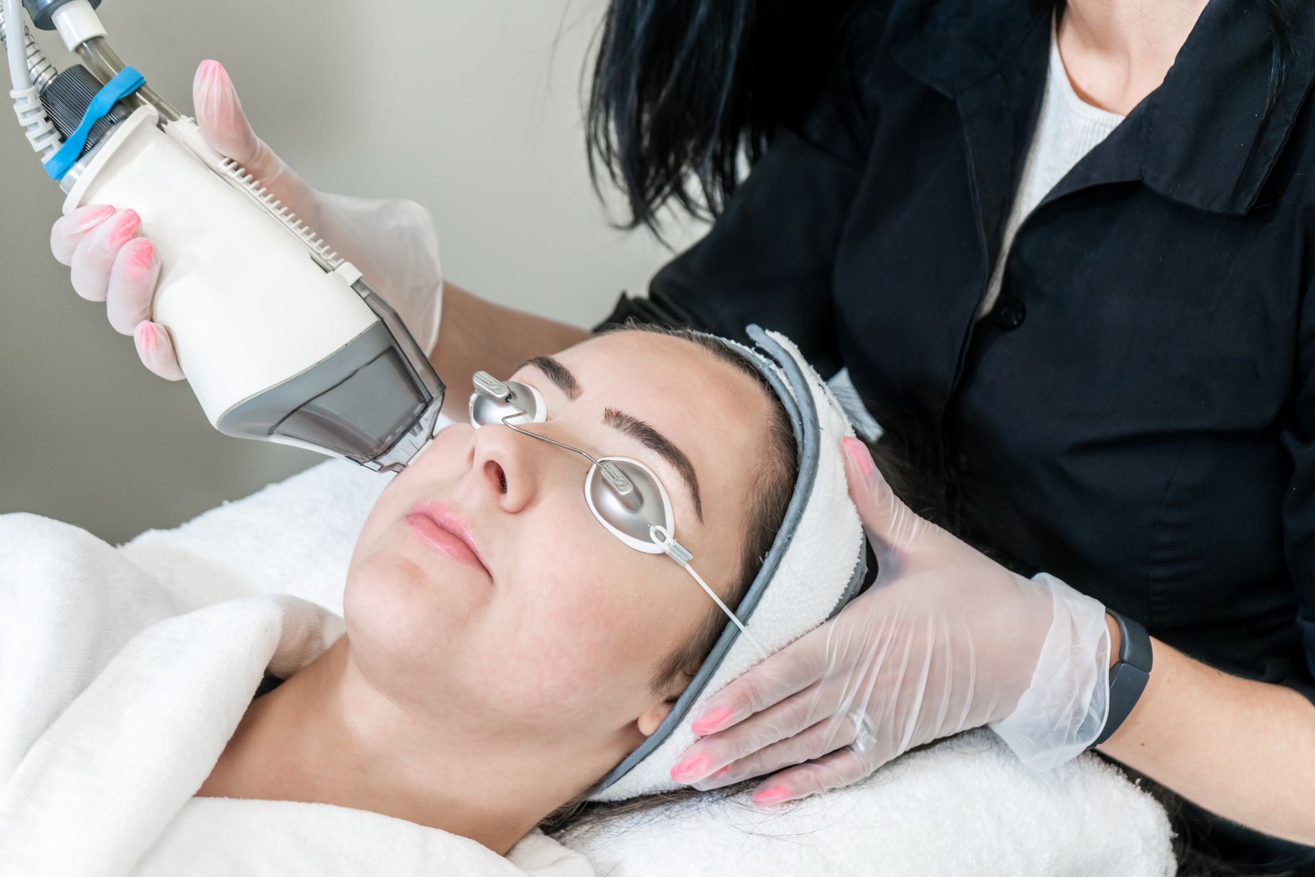 facial laser treatment