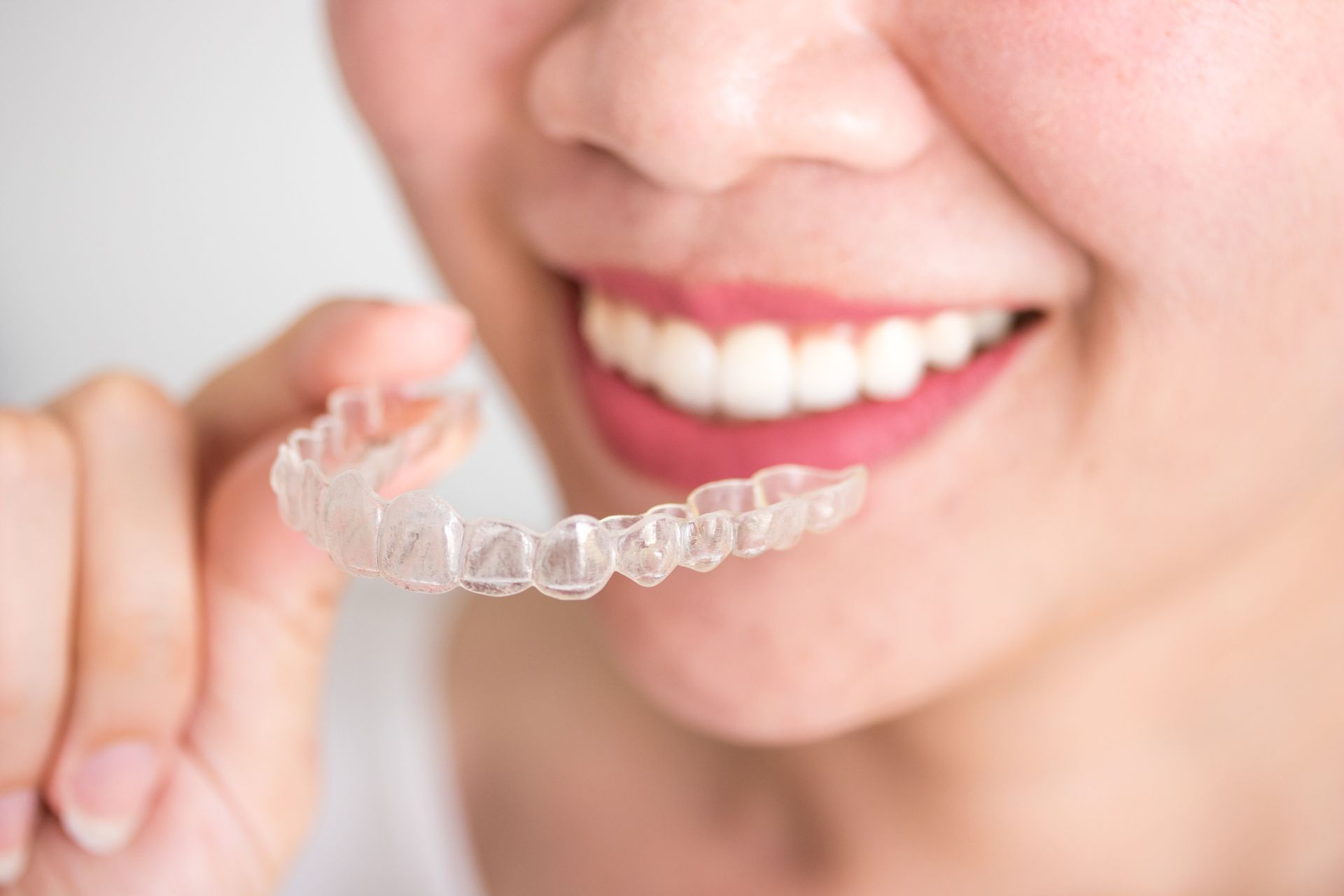 Close-up of mouth showing clear dental aligner retainer held by hand, transparent orthodontic braces