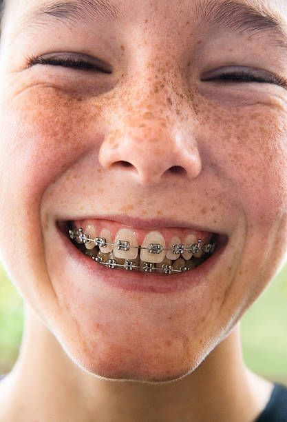 Close-up portrait of a smiling girl with braces and a bright and cheerful expression.