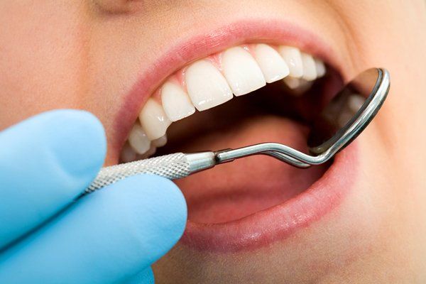 Using mirror spoon on teeth — Buffalo Grove, IL — Rosen Orthodontics