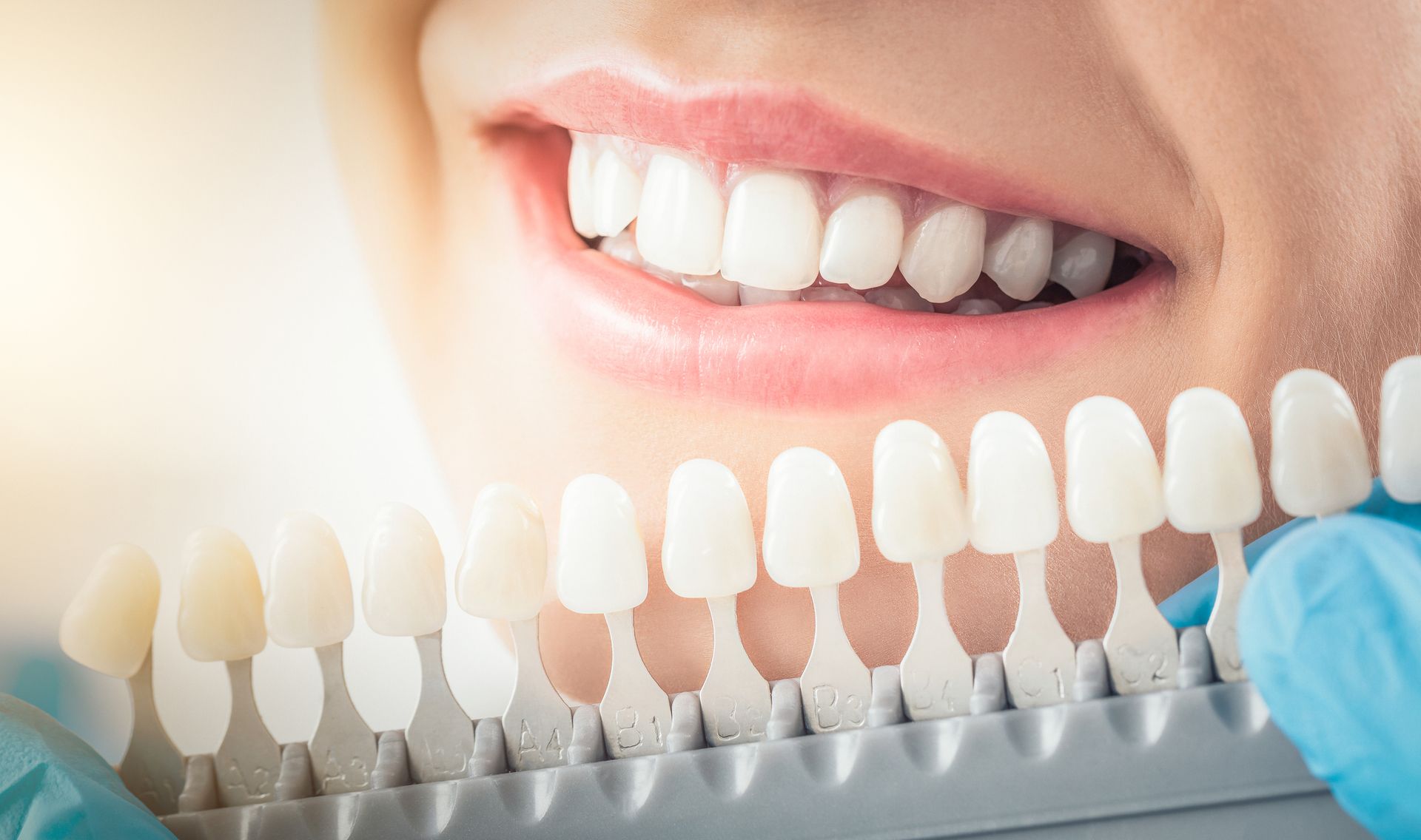 A woman is getting her teeth whitened by a dentist.