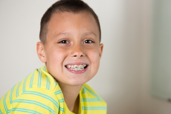 Smiling little boy with braces — Buffalo Grove, IL — Rosen Orthodontics