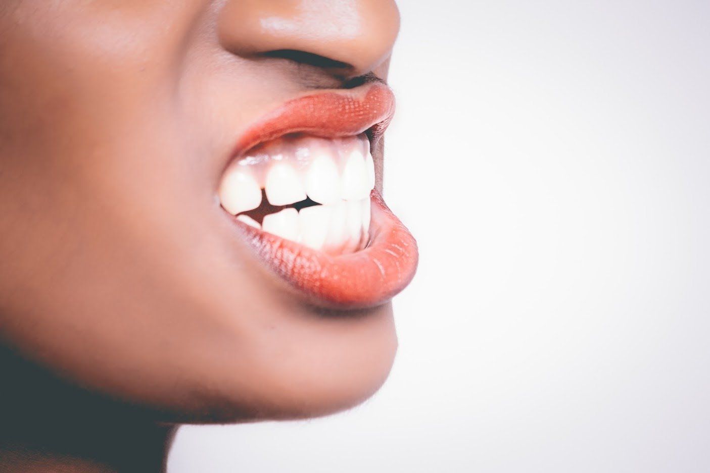 Woman showing her teeth — Buffalo Grove, IL — Rosen Orthodontics