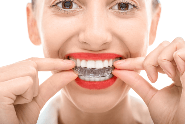 Woman showing her invisalign retainer — Buffalo Grove, IL — Rosen Orthodontics